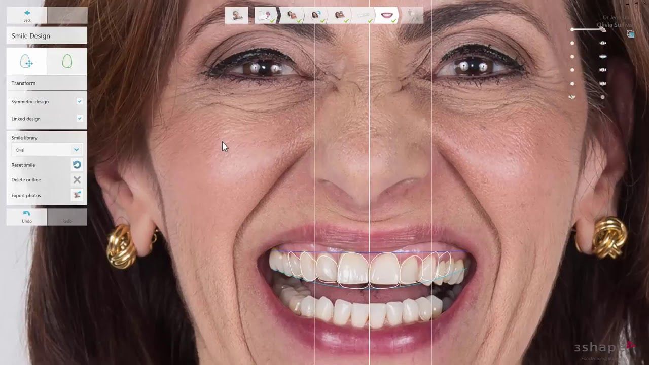 Digital Smile Design